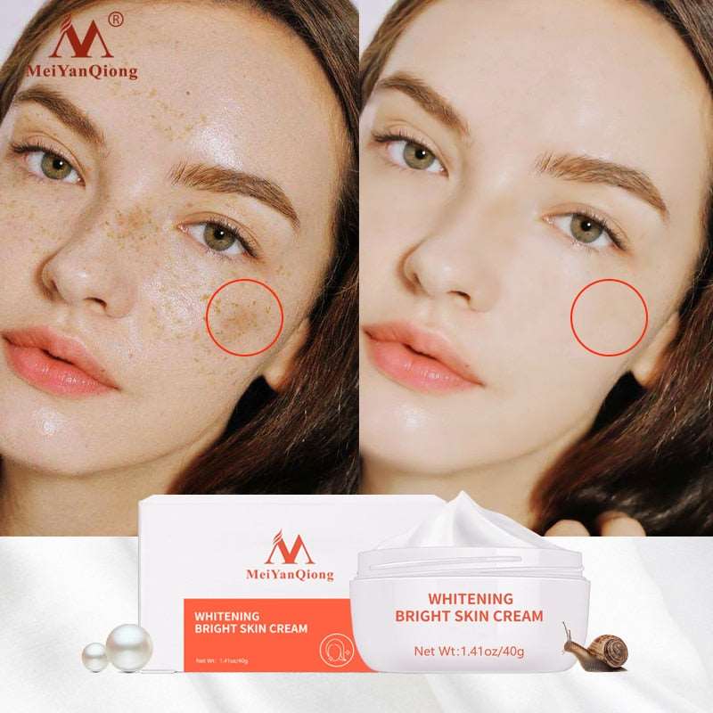 Moisturiser Face Whitening Freckle Cream Remove Acne Spots Melanin Dark Spots Face Lift Firming Face Skin Care Bright Skin Cream United States