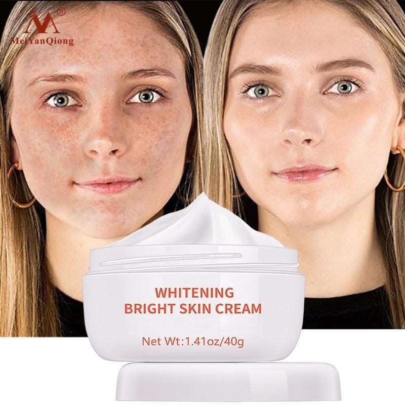 Moisturiser Face Whitening Freckle Cream Remove Acne Spots Melanin Dark Spots Face Lift Firming Face Skin Care Bright Skin Cream